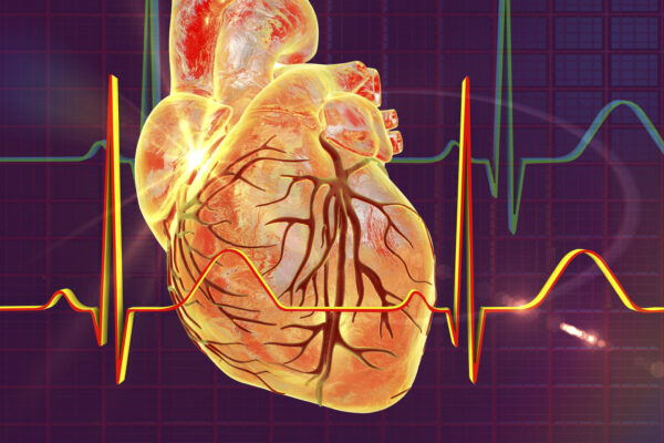 Inteligencia Artificial para prevenir el paro cardíaco repentino